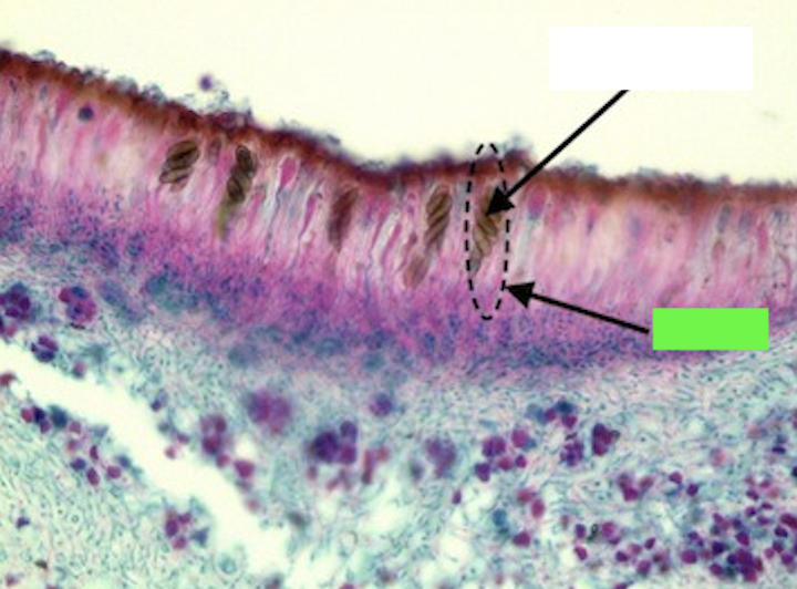 <p>What is the green arrow pointing to?</p>