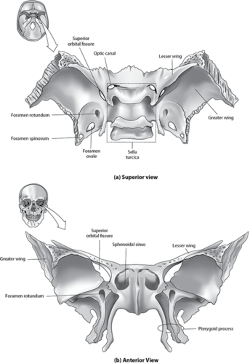 <p>lacerum</p><p>superior fissure (L. superior part of sphenoid)</p><p>rotundum: (L. middle portion of sphenoid)</p><p>spinosum(L. inferior portion of sphenoid)</p><p>ovale (R. inferior portion of sphenoid)</p><p>optic (R. superior portion of sphenoid)</p>