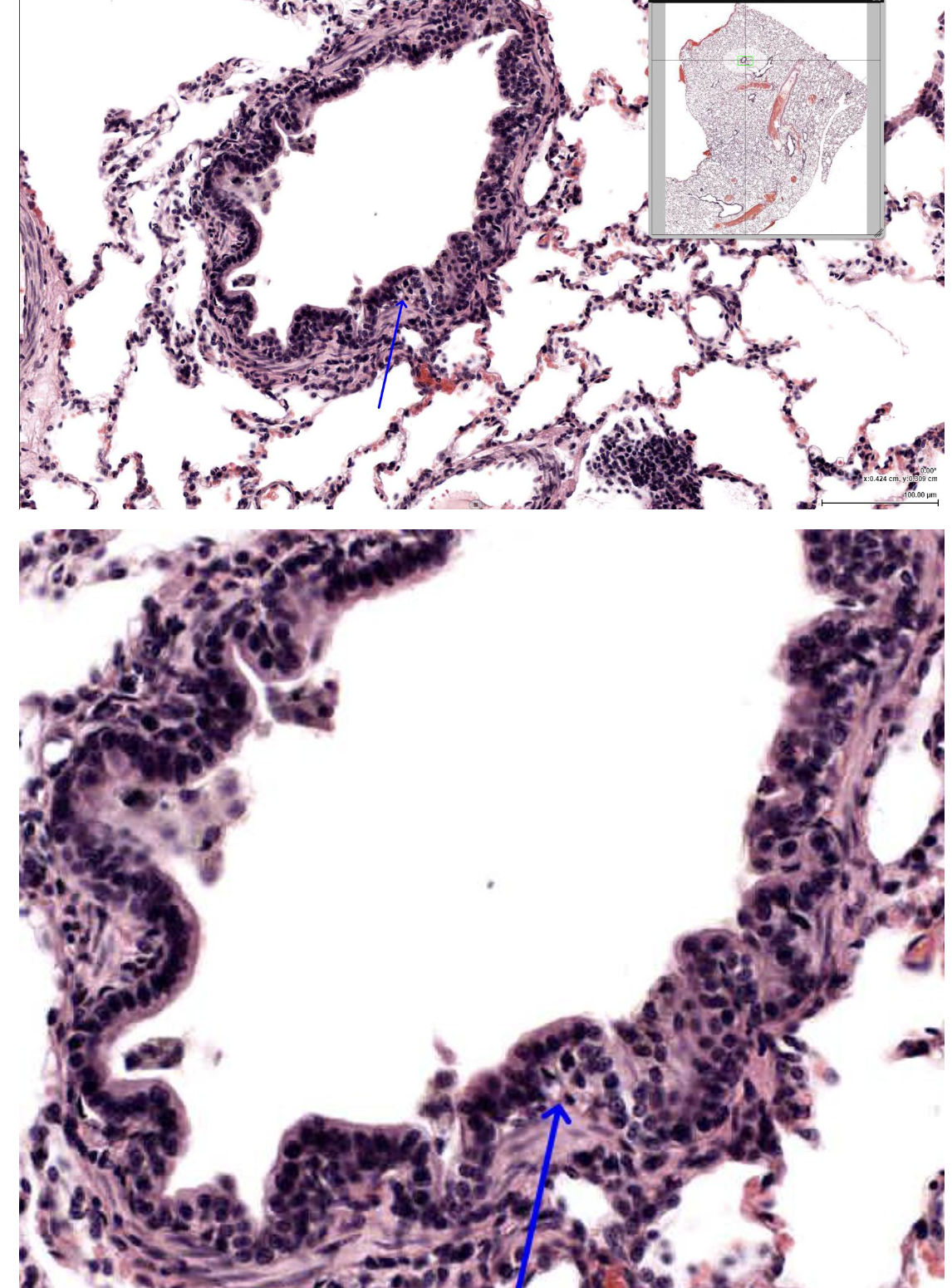 <p><span><span>The layer indicated by the arrow is most likely which of the following?</span></span></p>