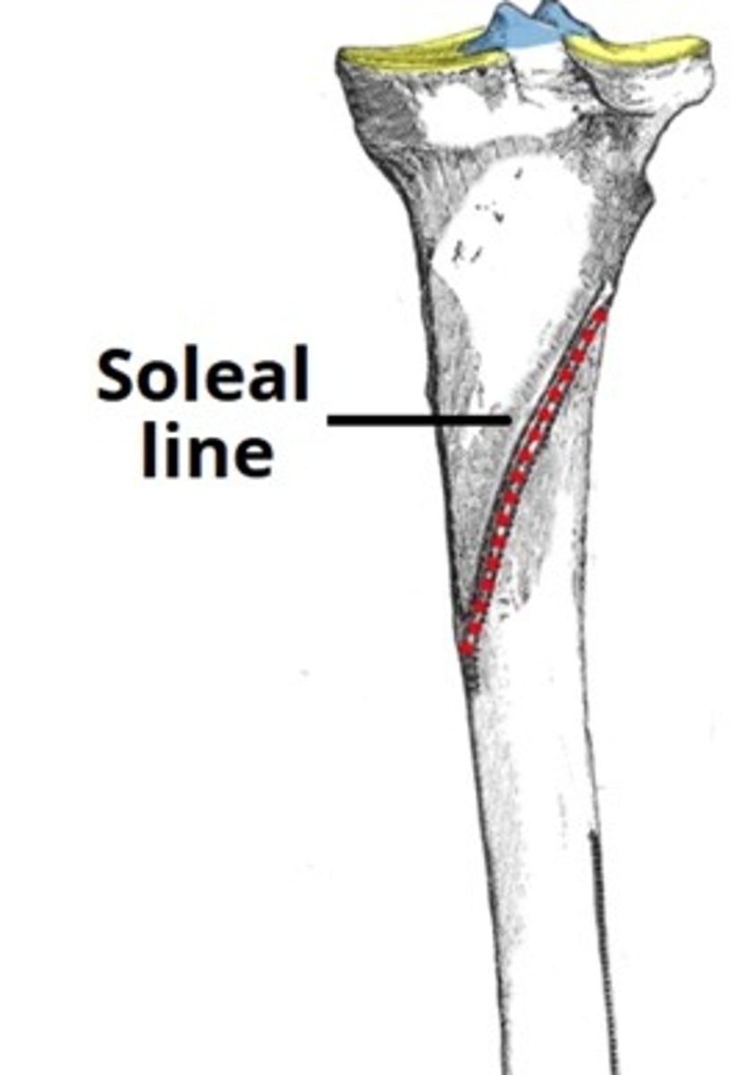 <p>Soleal Line</p>