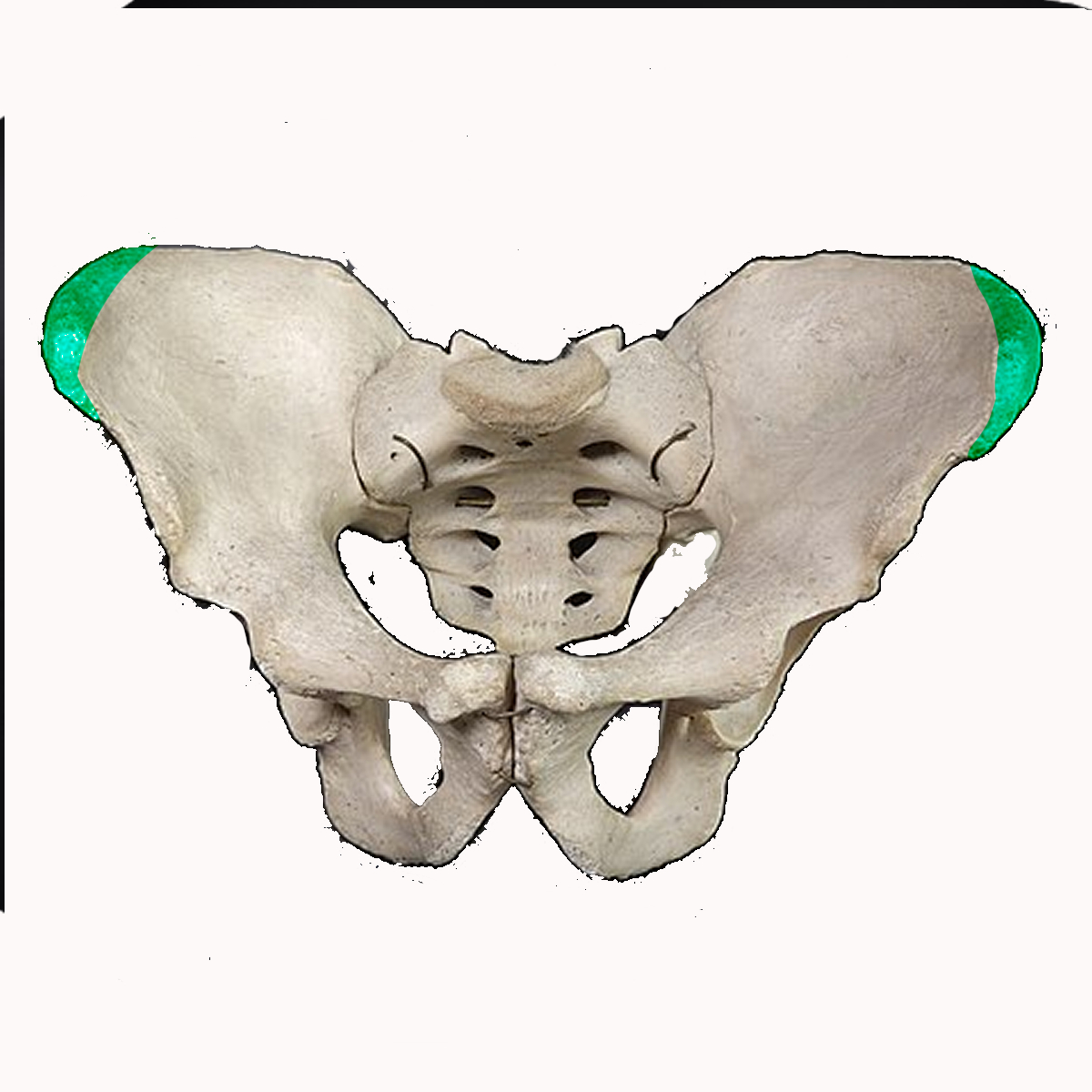 <p>Name the highlighted feature of the pelvis</p>