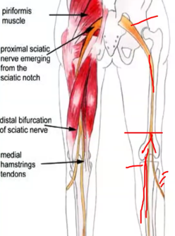 <p><strong>True </strong>or <strong>False</strong>: The <strong>tibial </strong>portion of the <em>sciatic </em>nerve is found laterally in the leg</p>