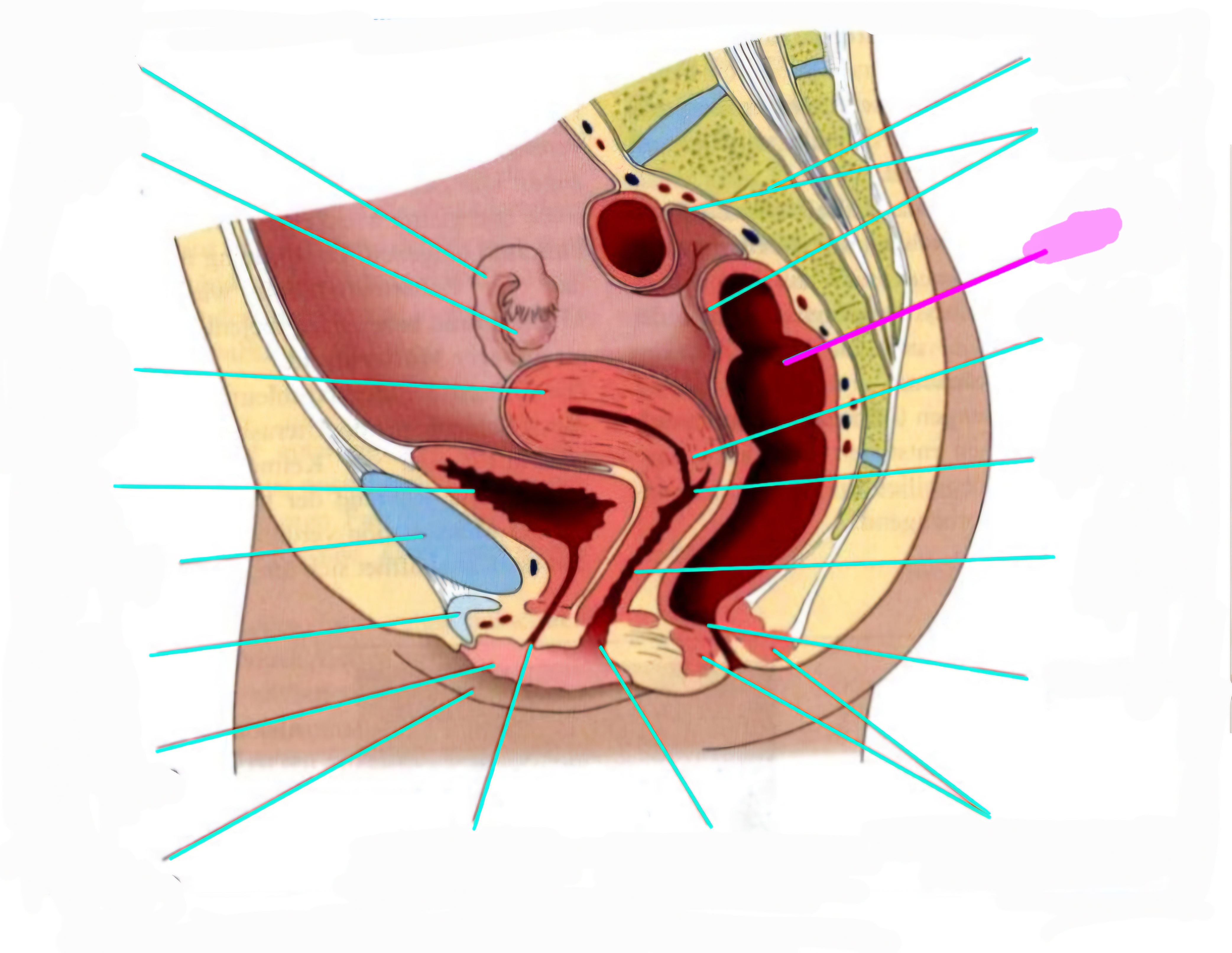 term image