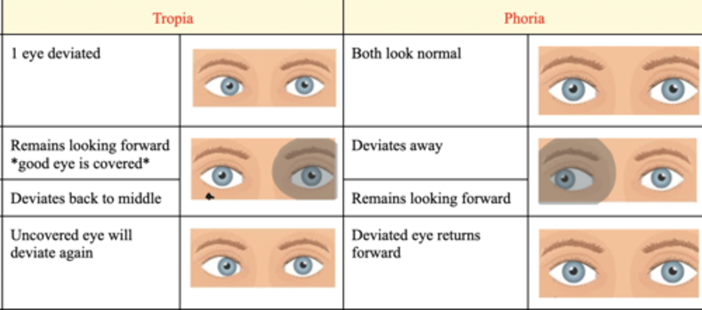<p>A. Phoria</p><p>* Tropia and Phorias are terms to describe when the eyes are not in alignment with each other</p><p>* A tropia is always present, while phorias are there "some of the time," such as when the patient is tired or when fusion is broken (you cover an eye and it starts to drift).</p>