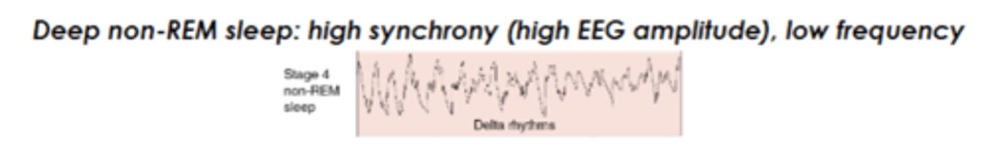 <p>high amp, low frequency</p>