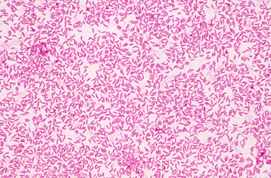 <p>ID this cellular morphology</p>