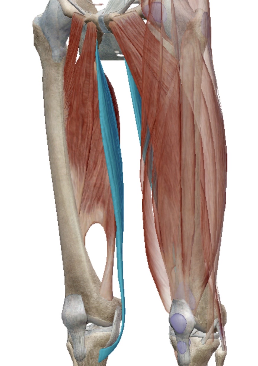 <p>Identify this muscle</p>