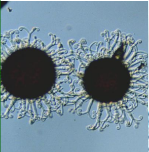 <p>-”kuleczki”<br>-brak otworu<br>-trwałe perydium<br>-uwolnienie zarodników przez uszkodzenie owocnika<br>-brak hymenium, bezładny układ worków<br>-obecne przyczepki</p><p>-np. <em>Ersiphe palczewskii</em></p>