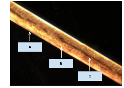 <p><span>Which of the following is the </span><strong>medulla</strong><span>, which technicians may look at to measure its relative width, see if it is continuous or fragmented, or opaque or translucent?</span></p>