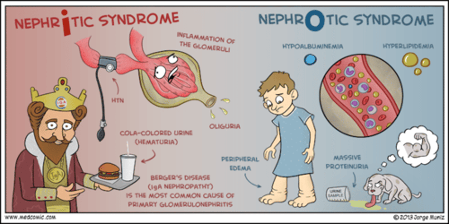 <p>nephritic syndrome → steroids for inflam, reduce BP with water/Na+ restriciton/diuretics/diaysis</p>