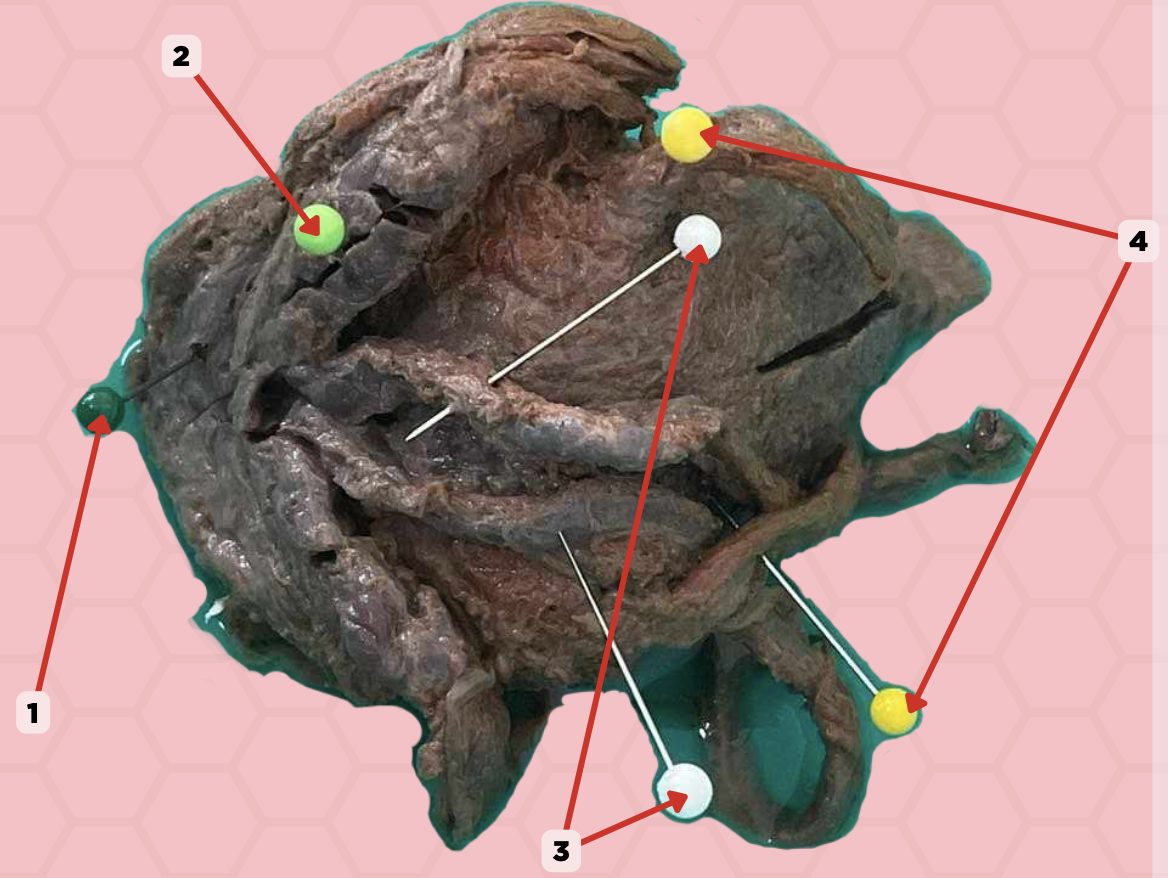 <p>What pin is included in the spermatic cord?</p><p>a. Yellow pin</p><p>b. White pin</p><p>c. Light green pin</p><p>d. Dark green pin</p>