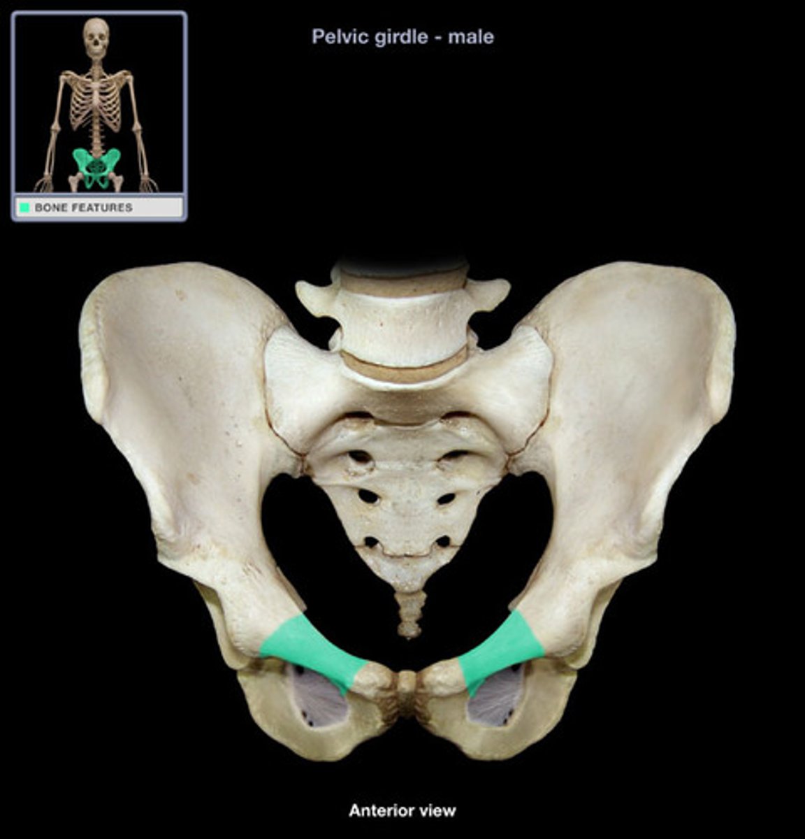 <p>flattened superior border of the obturator foramen</p>