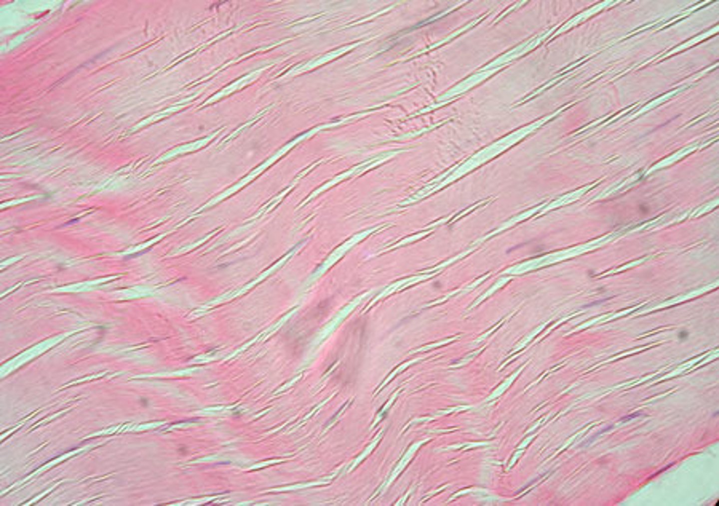 <p>tendons and ligaments</p>
