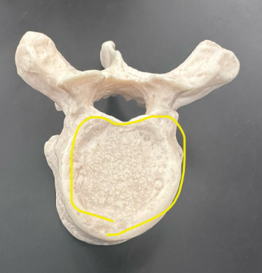 <p>What is circled in yellow?</p>