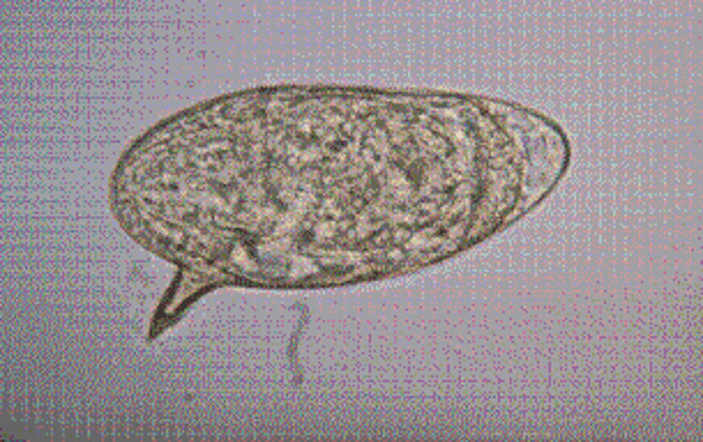 <p>a.Schistosoma mansoni.</p><p>S. mansoni, which is most commonly found in Africa, parts of South America, the West Indies, and Puerto Rico, lives in venules of the mesentery and large intestines. The egg of S. mansoni is yellowish, elongated and 115 to 175 μm by 45 to 75 μm, and has a prominent lateral spine.</p>