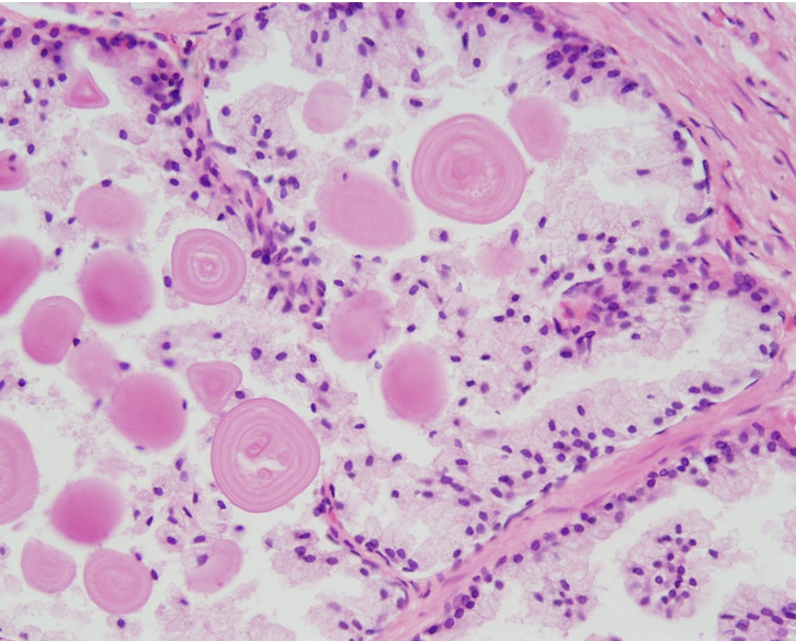 <p>Prostate</p>