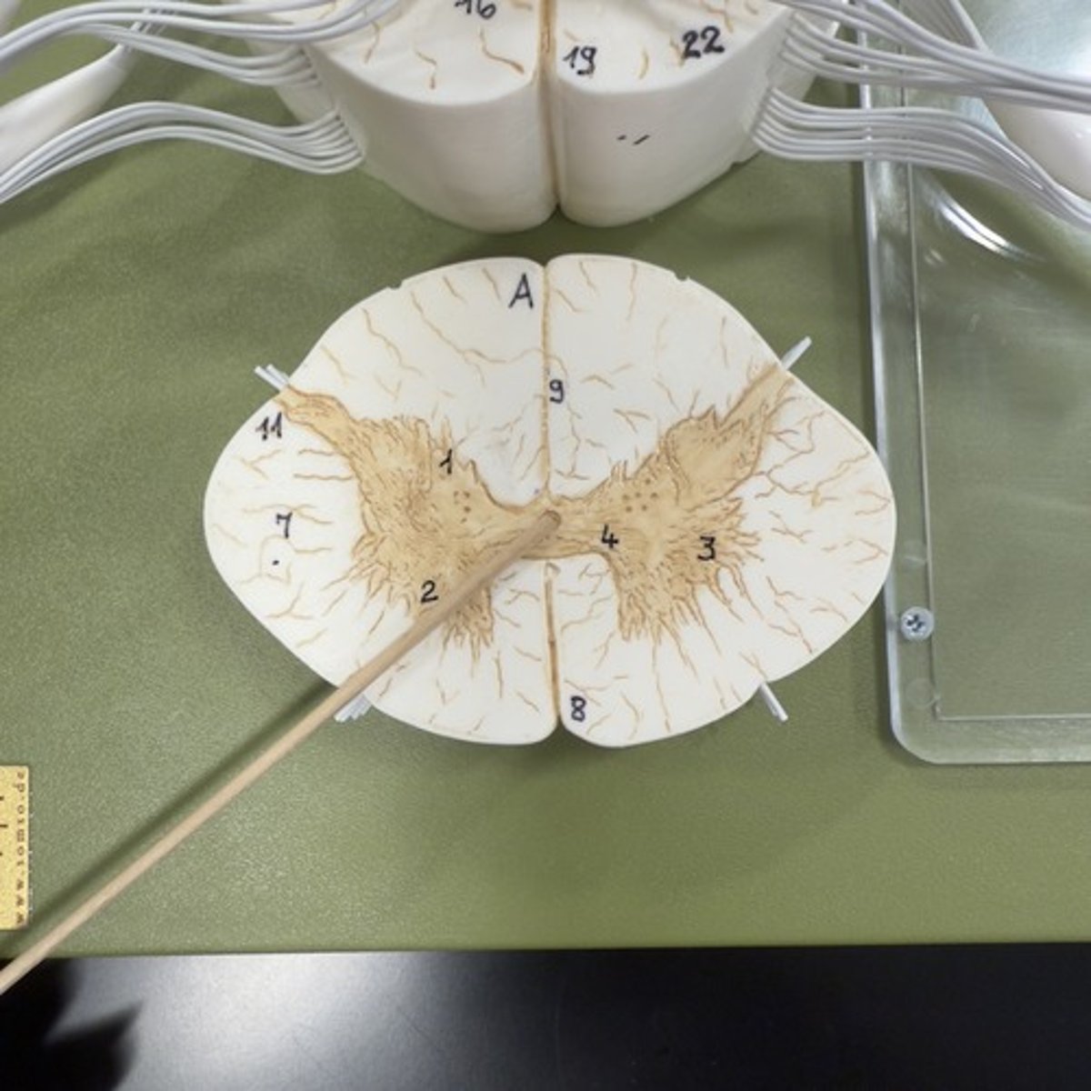 <p>Identify the structure.</p>