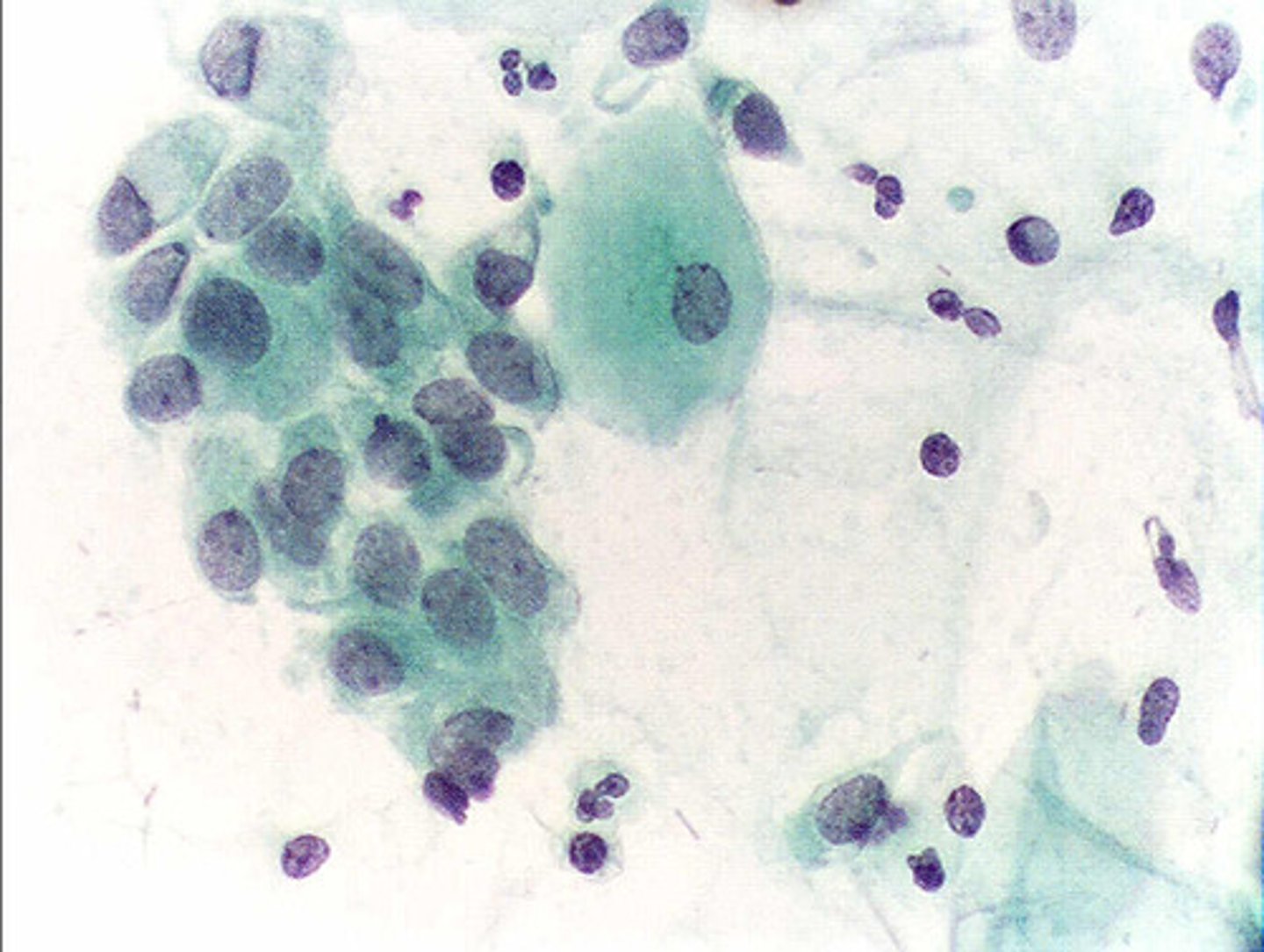 <p>The use of dyes such as iodine or methylene blue to better see cells and sub-cellular structures under a light microscope</p>