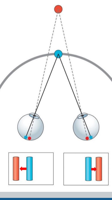 <ul><li><p>Image shifts inward on both retinas</p></li><li><p>Object is farther / behind the horopter</p></li></ul><p></p>