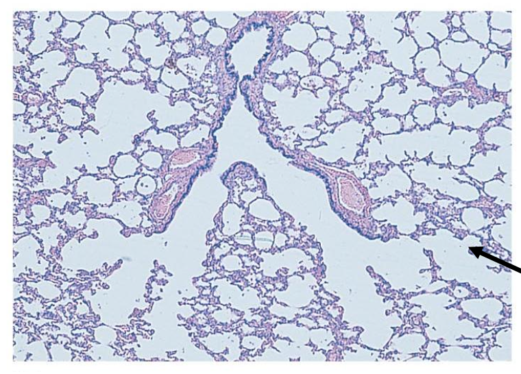 <p>The photo is a micrograph of a part of the lung. The arrow is pointing to</p><p></p><p>a. Bronchiole</p><p>b. Alveolar duct</p><p>c. Alveolus</p><p>d. Pleura</p>