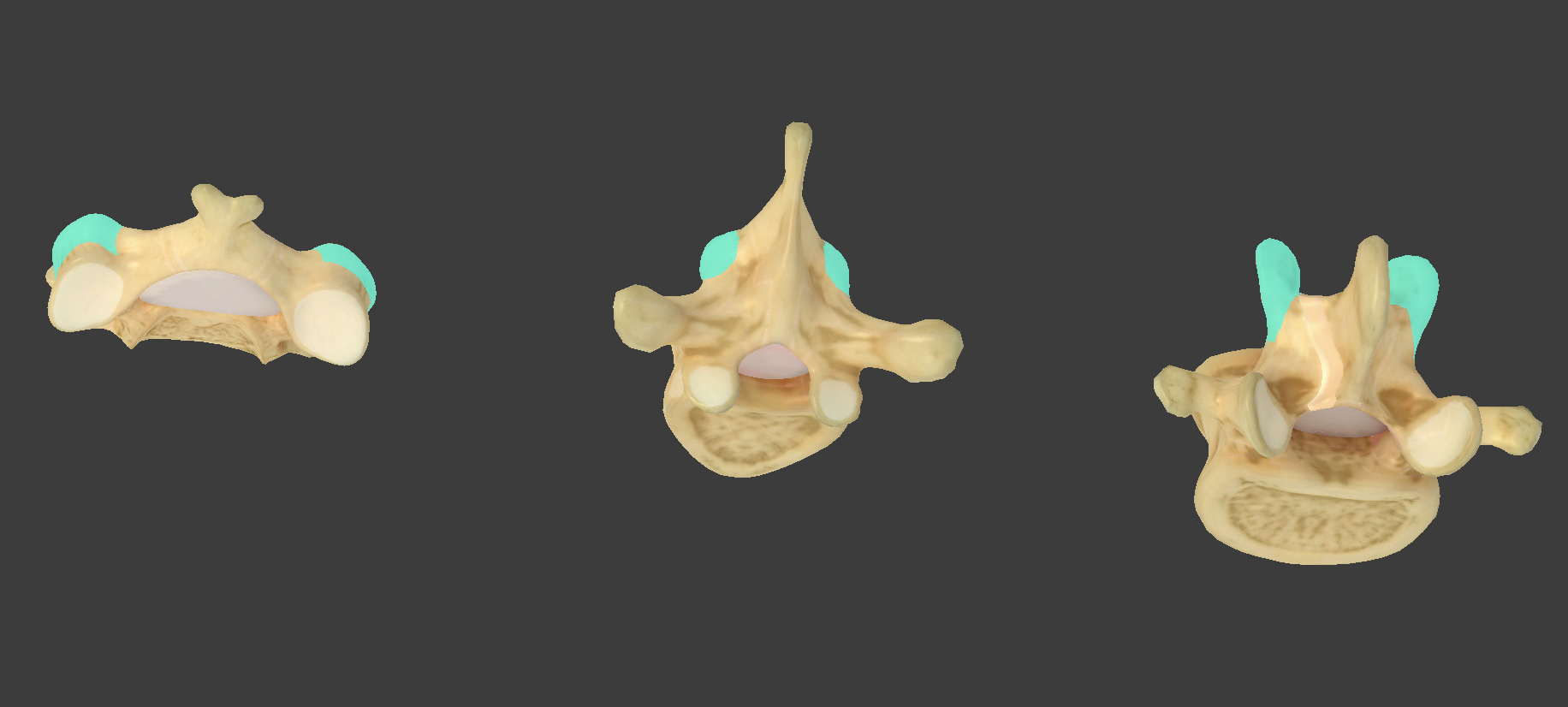 <p>what component of vertebrae is this?</p>