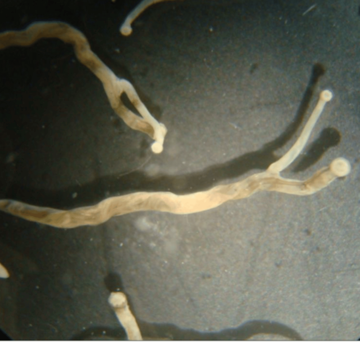 <p>Found in outdoor-reared chicken showing dyspnoea and weight loss. What parasite species is this?</p>