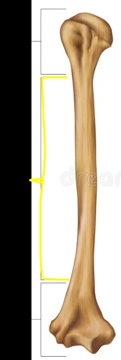 <p>Which section of the long bone is this? </p>