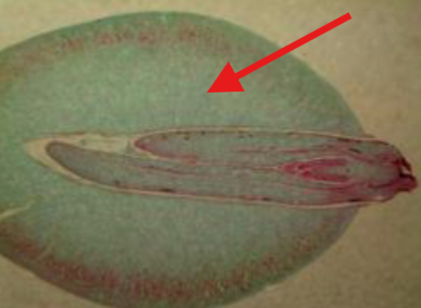 <p>What is being indicated on the Ginkgo Mature Seed?</p>