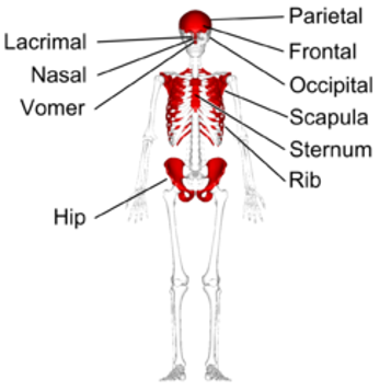 <p>Examples of flat bones include the skull, ribs, sternum, scapula, and pelvis.</p>