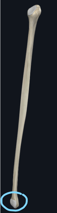 <p>What part of the fibula is this</p>