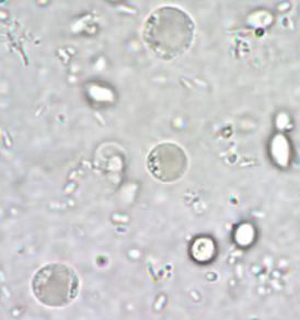 <p>Professor: Dr. Glena Fe A. Yapchulay-Alcabasa</p>