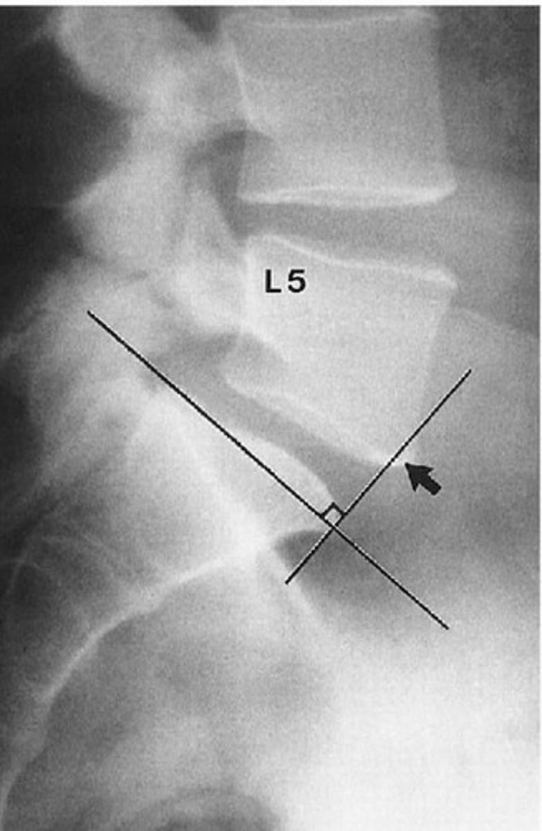 <p>What line of mensuration is this?</p>