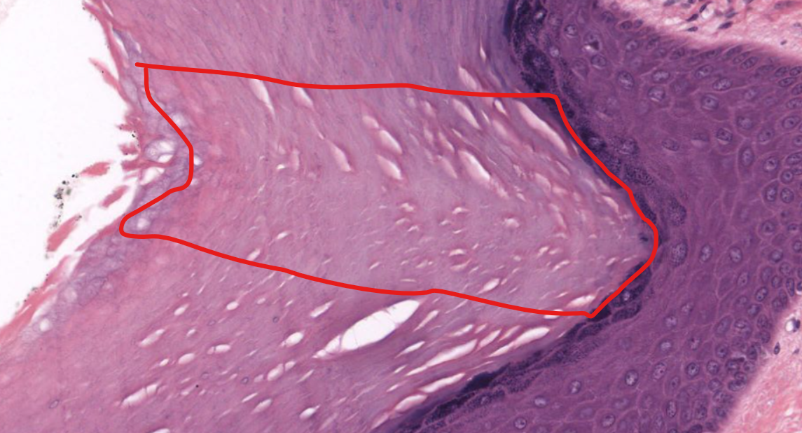<p>(notice the lack of nuclei and other organelles)</p>