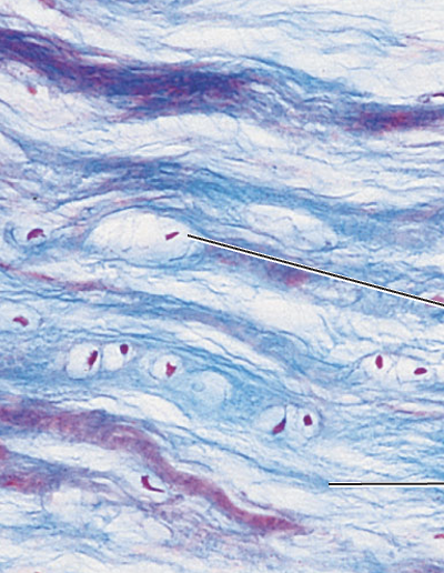 <p>What tissue type does this image depict?</p>