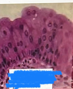 <p>What tissue is this?</p>