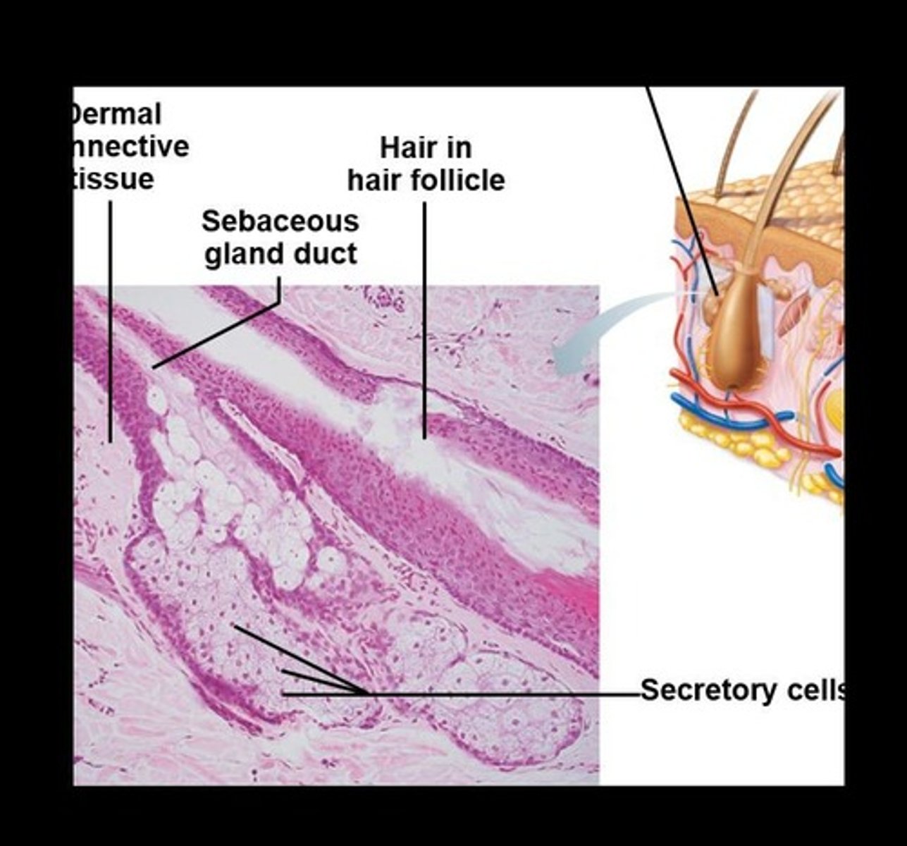 <p>Glands that secrete sebum, widely distributed but not in thick skin of palms and soles.</p>