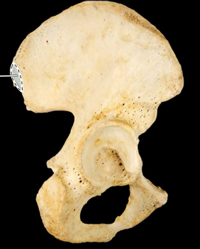 <p>Hip bone, lateral view, right ilium</p>