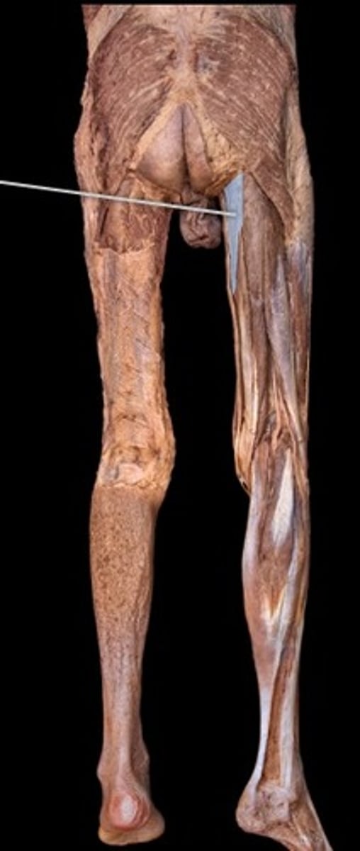 <p>What muscle is this?</p>