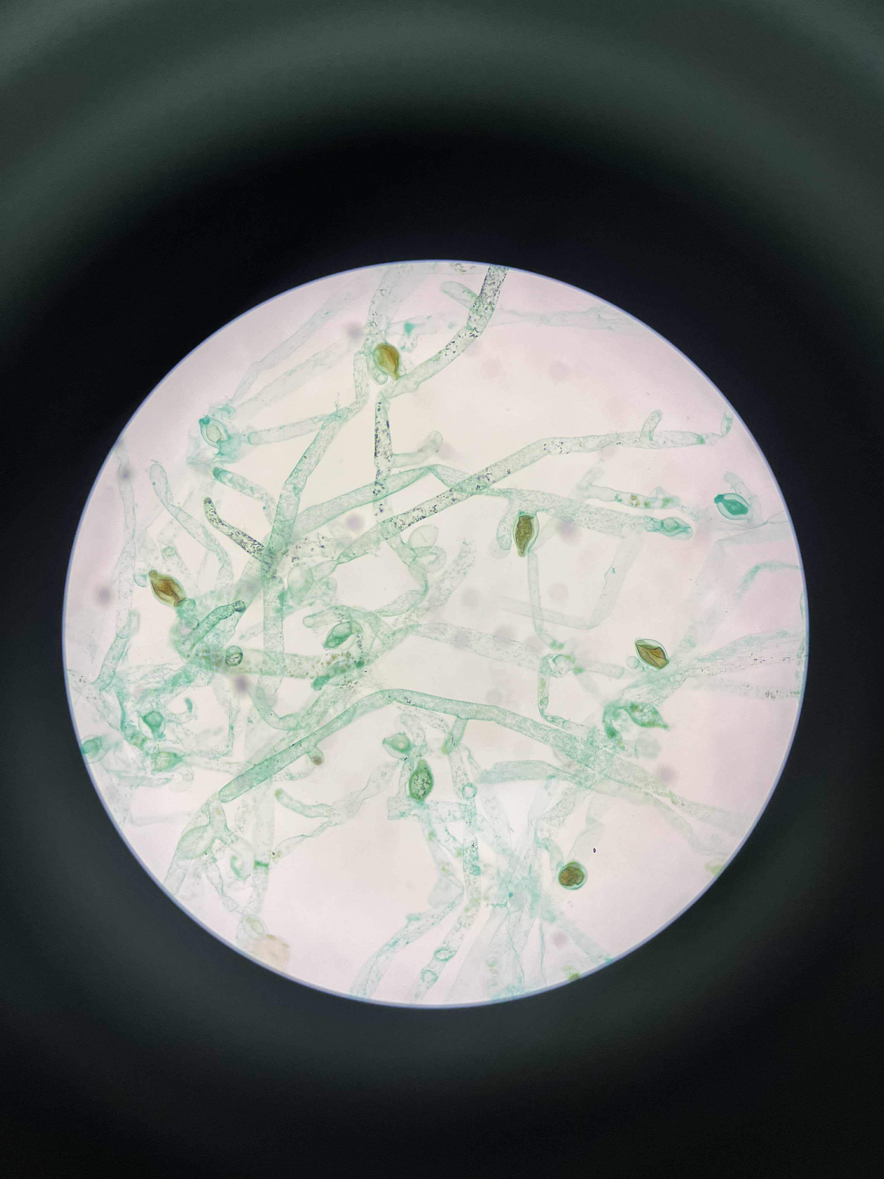 <p>specimen</p><p>phylum</p><p>color</p><p>shape</p><p>cell arrangement</p><p>motility</p><p>characteristic</p>