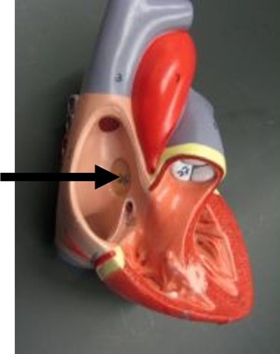 <p>A depression in the interatrial septum of the heart, representing the remnant of the foramen ovale.</p>