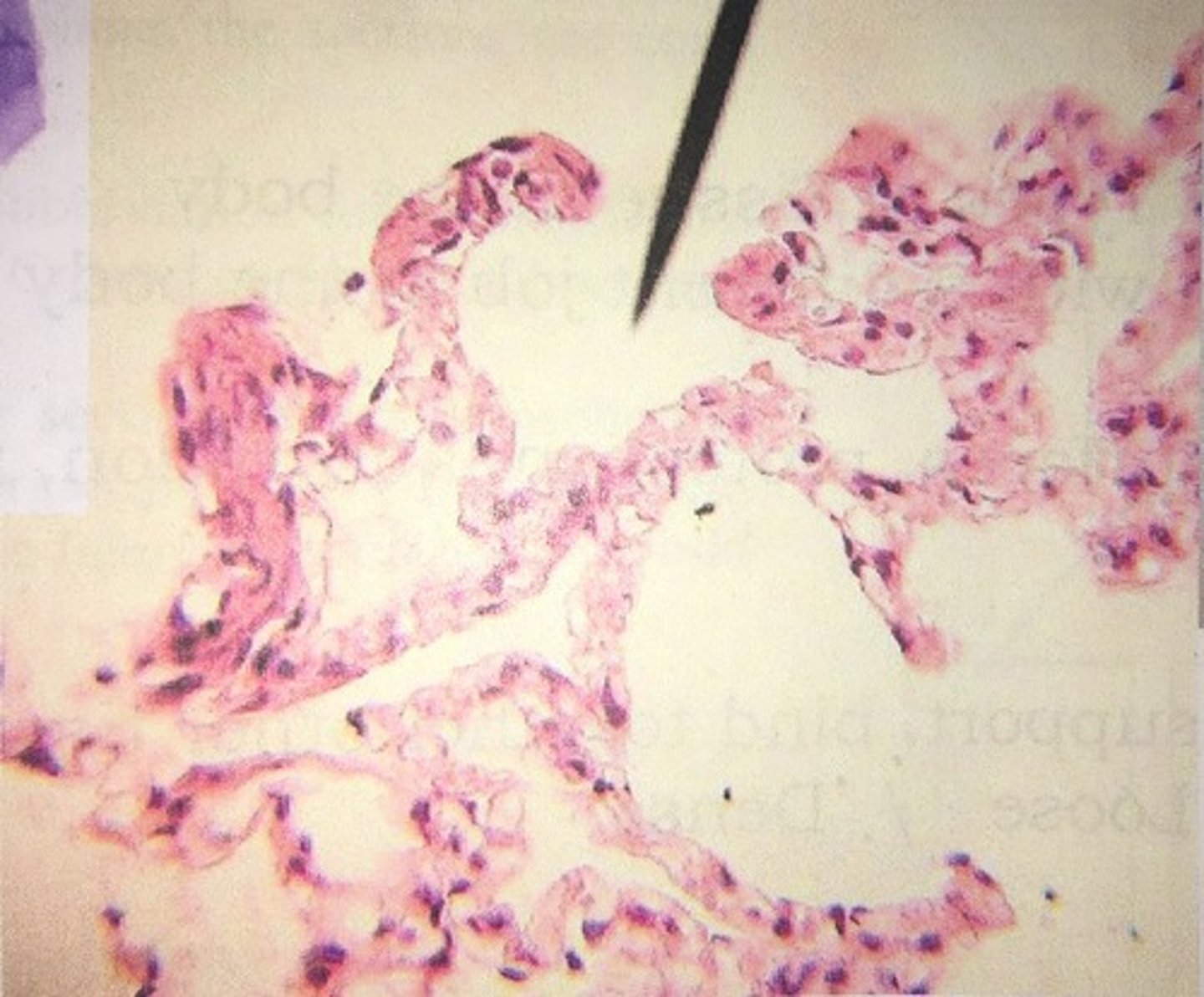 <p>Location: Air Sacs of Lungs</p><p>Function: Allows Passage of Materials</p>