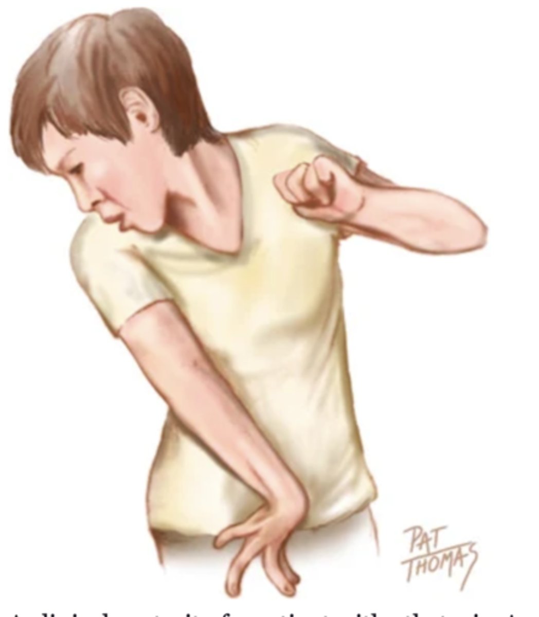 <p>Twisting continuous movement; slow and usually involves a distal limb</p>