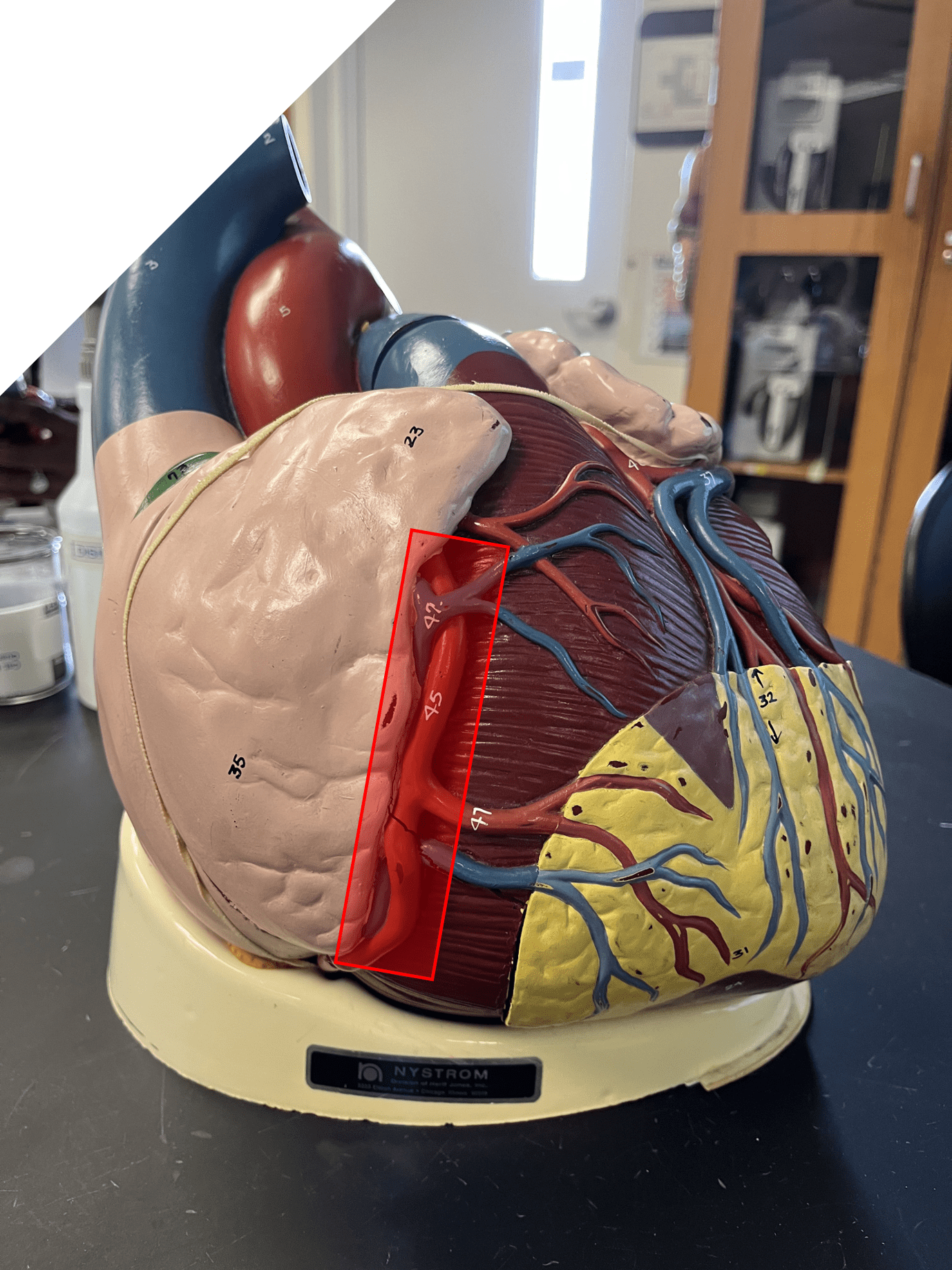 • Part of the coronary circulation.

• Passes around the lateral right side in the coronary sulcus of the heart and then posterior to the ventricles.

• Arises from the base of the aorta.

• Branches into the posterior interventricular and marginal arteries.