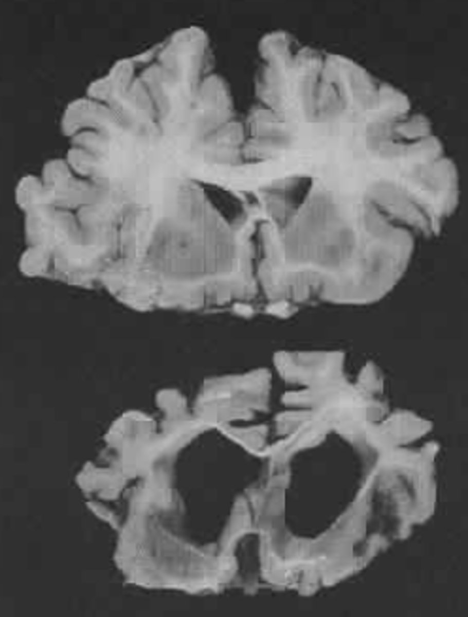 <p>- Position of body in space</p><p>- Ability to locate and express pain</p><p>- Awareness of feeling in most of the body</p>