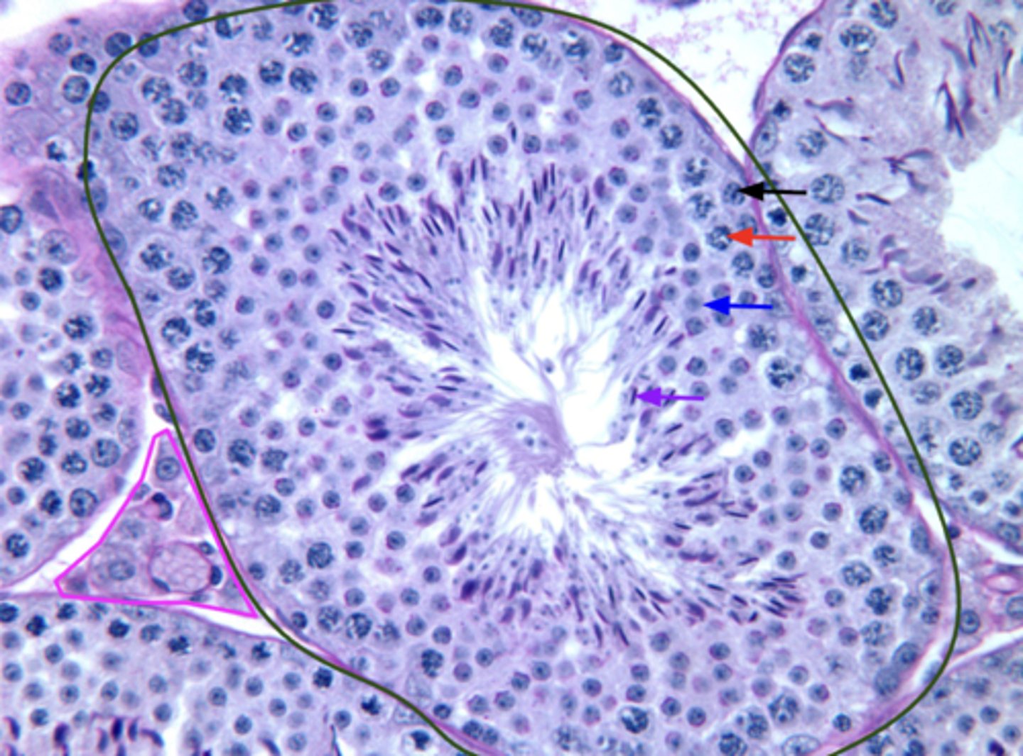 <p>What is the pink outline?</p>