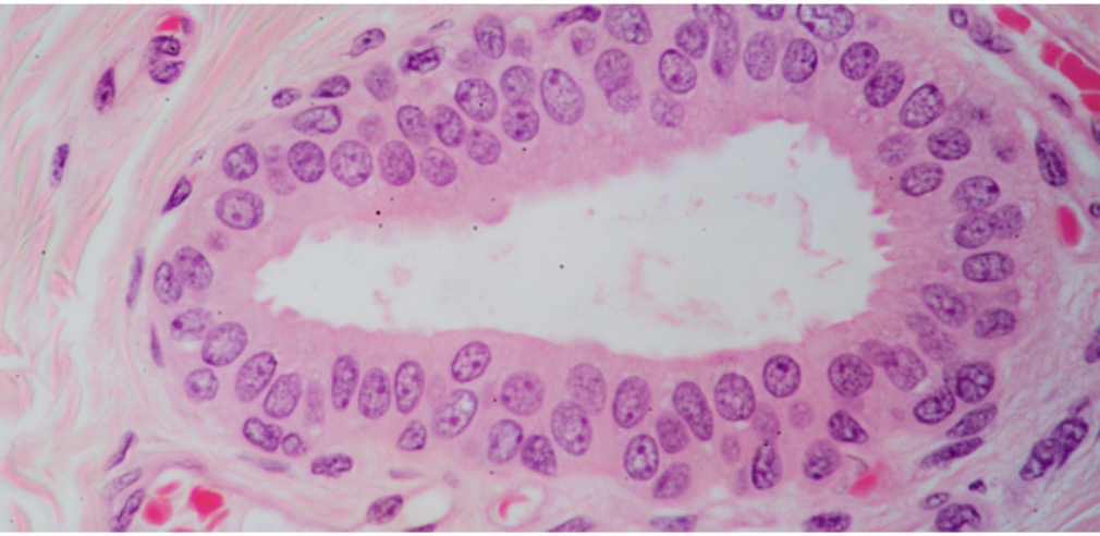 <p>what type?</p>