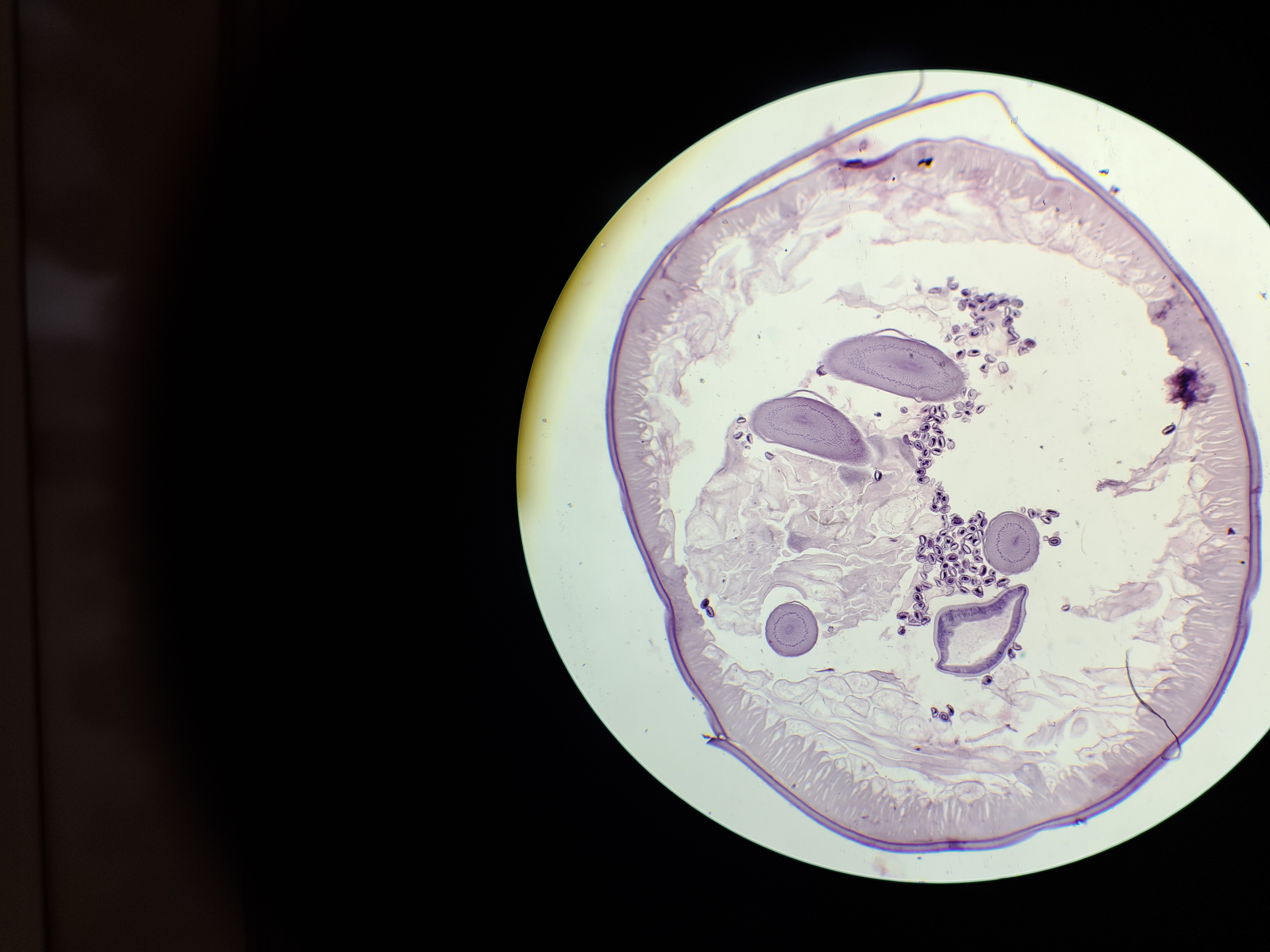 <p>kmen: NEMATODA (hlístice)</p>