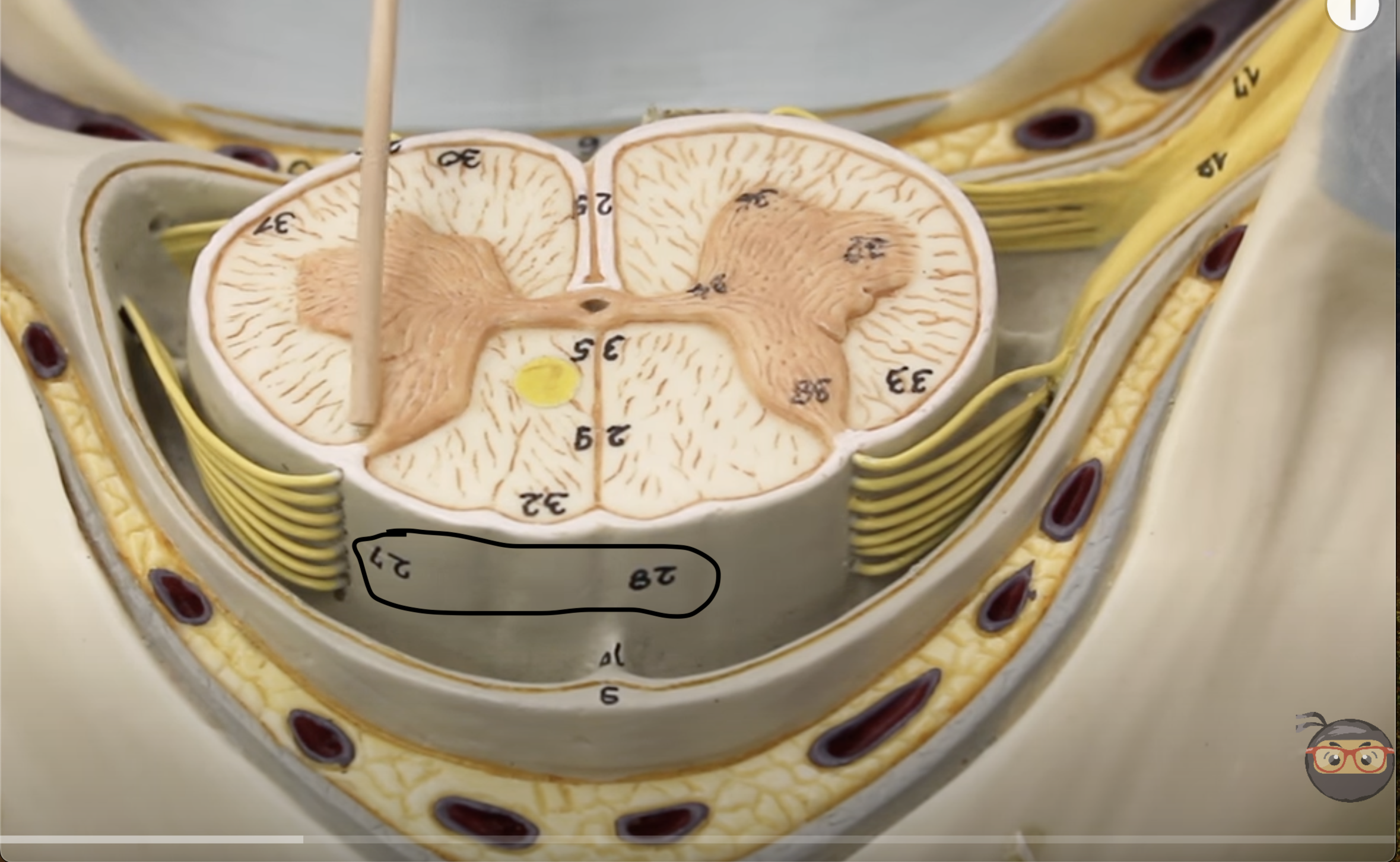 <p>what is this part of the vertebrae (of the spinal cord?)</p>