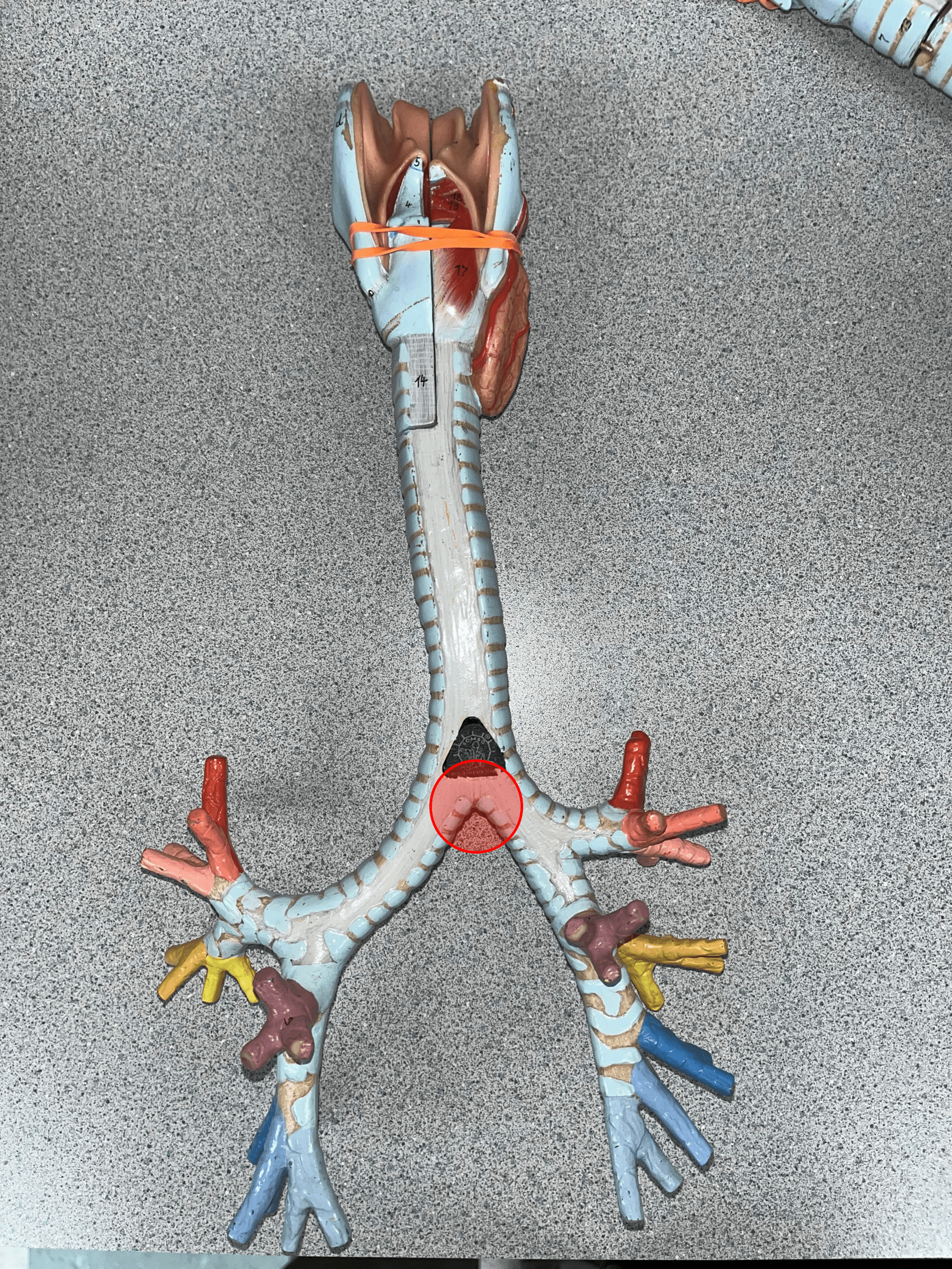 • The termination of the trachea.

• The trachea splits into primary bronchi at this point.