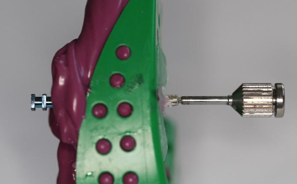 <p>When is the analog connected to the impression coping?</p>